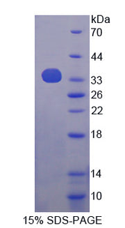 Figure 1. SDS-PAGE