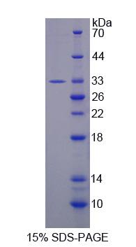 Figure 1. SDS-PAGE