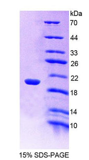 Figure 1. SDS-PAGE