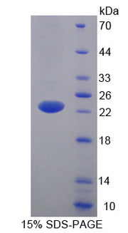 Figure 1. SDS-PAGE