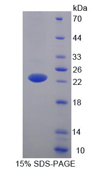 Figure 1. SDS-PAGE
