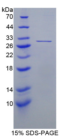 Figure 1. SDS-PAGE