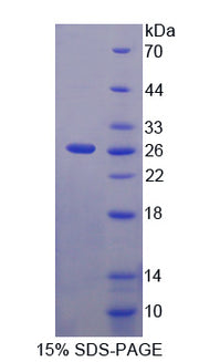 Figure 1. SDS-PAGE