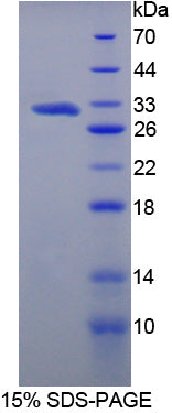 Figure 1. SDS-PAGE