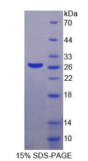 Figure 1. SDS-PAGE