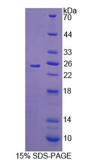 Figure 1. SDS-PAGE