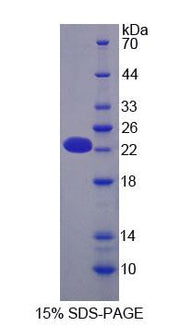 Figure 1. SDS-PAGE