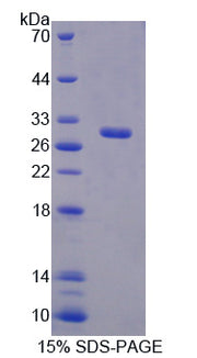 Figure 1. SDS-PAGE