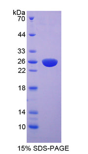 Figure 1. SDS-PAGE