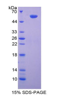 Figure 1. SDS-PAGE