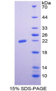 Figure 1. SDS-PAGE