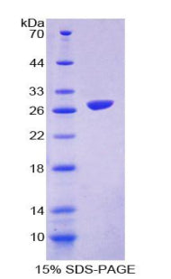 Figure 1. SDS-PAGE