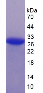 Figure 1. SDS-PAGE