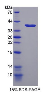 Figure 1. SDS-PAGE