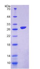 Figure 2. SDS-PAGE