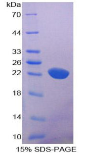 Figure 1. SDS-PAGE