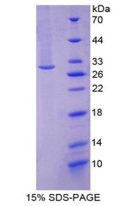 Figure 1. SDS-PAGE