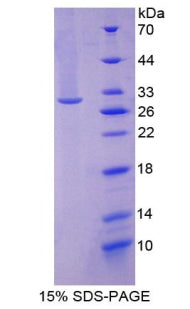 Figure 1. SDS-PAGE