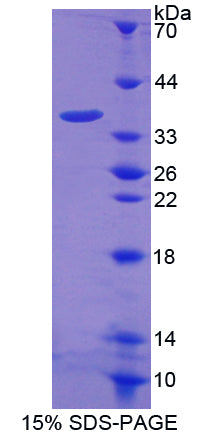Figure 1. SDS-PAGE