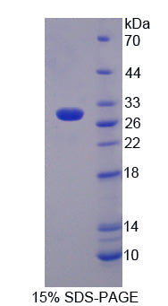 Figure 1. SDS-PAGE