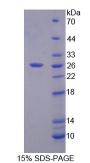 Figure 1. SDS-PAGE