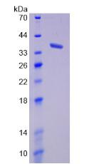 Figure 2. SDS-PAGE