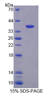 Figure 1. SDS-PAGE