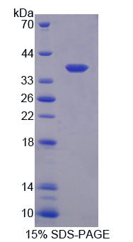 Figure 1. SDS-PAGE