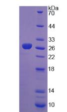 Figure 2. SDS-PAGE