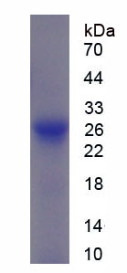 Figure 1. SDS-PAGE