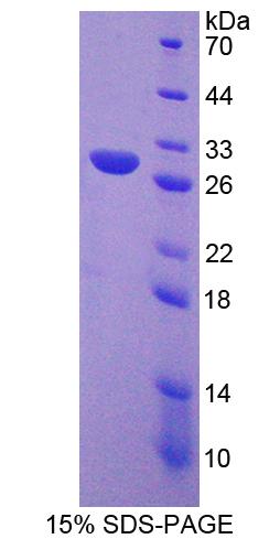 Figure 1. SDS-PAGE