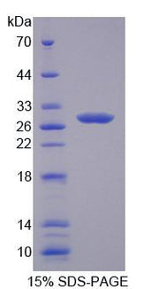 Figure 1. SDS-PAGE