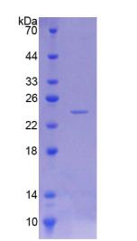 Figure 1. SDS-PAGE