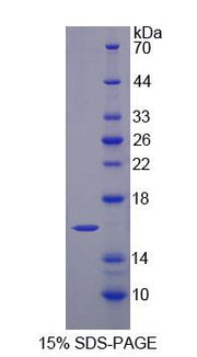 Figure 1. SDS-PAGE