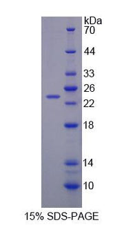 Figure 1. SDS-PAGE