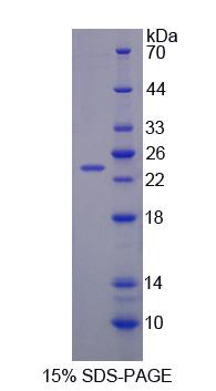 Figure 1. SDS-PAGE