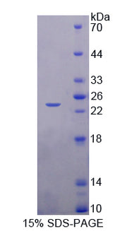 Figure 1. SDS-PAGE