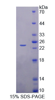 Figure 1. SDS-PAGE