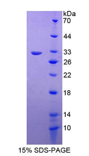 Figure 1. SDS-PAGE