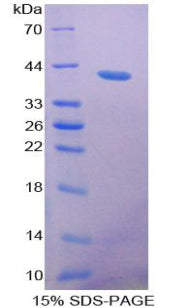 Figure 1. SDS-PAGE