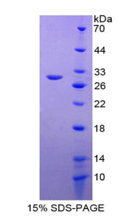 Figure 1. SDS-PAGE