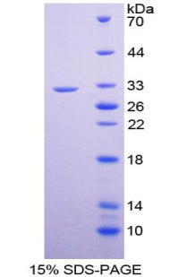 Figure 1. SDS-PAGE