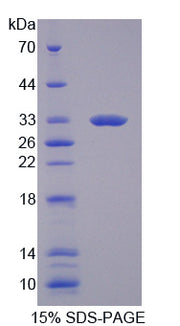 Figure 1. SDS-PAGE