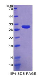 Figure 1. SDS-PAGE