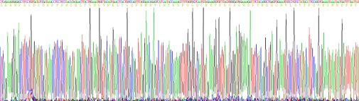Recombinant Human Complement Component 7 (C7)