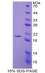 Figure 1. SDS-PAGE