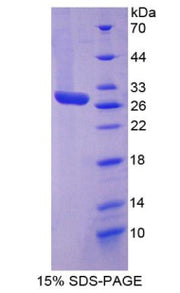 Figure 1. SDS-PAGE