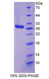 Figure 1. SDS-PAGE