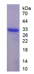 Figure 1. SDS-PAGE