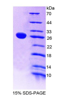 Figure 1. SDS-PAGE